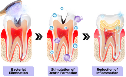 🎁Flash Sale - Don’t Miss Out - DOCTIA® Teeth Restoration Mineral Powder🦷(ADA recommended)👩‍⚕️(Treats periodontitis and mouth ulcers, prevents tooth loss, and repairs gum recession)